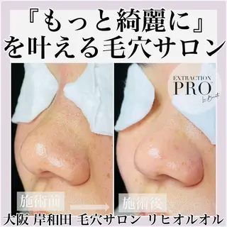 毛穴汚れ改善専門店/ 岸和田/リヒオルオルのエステ・リラクイメージ