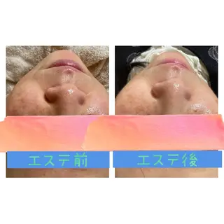 癒し×小顔×毛穴ケア サロンSourilのエステ・リラクイメージ