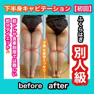 痩身/脱毛/ネイル HARUKAのエステ・リラクイメージ