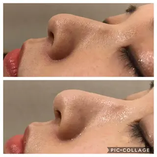 セミロング カラー パーマ ヘアアレンジ キッズ ネイル マツエク・マツパ Ensor Clair所属・EnsorClair 代表 野口真央のエステ・リラクイメージ