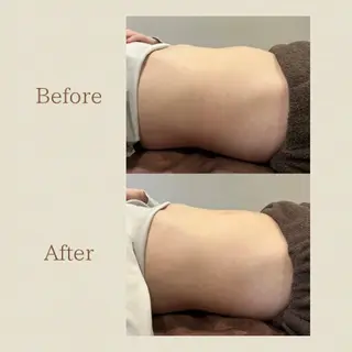 お腹痩せエステ Flat BELLY 恵比寿所属・【腸もみ/脂肪冷却】 お腹エステ/恵比寿のエステ・リラクイメージ