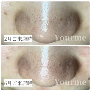 毛穴ケア専門サロン Yourmeユアミーのエステ・リラクイメージ
