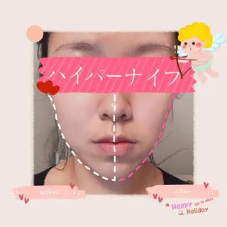 OPREA 栄店のエステ・リラクイメージ