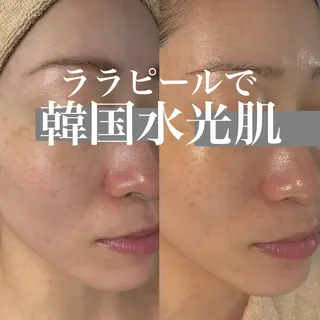 WHITE AQUA 北千住店のエステ・リラクイメージ