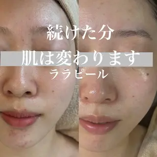 WHITE AQUA 北千住店のエステ・リラクイメージ