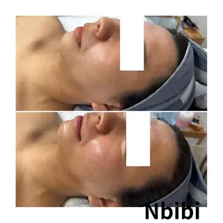 韓国🇰🇷価格 サロン_Nbibiのエステ・リラクイメージ