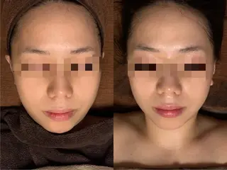 lymph care 'Welnəsのエステ・リラクイメージ