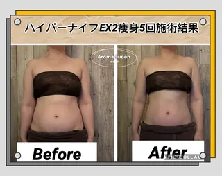 アロマクイーン所属・所沢痩身小顔コルギ AromaQueenのエステ・リラクイメージ