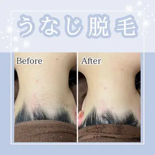 メンズ Amaryllis 🌹松本のエステ・リラクイメージ