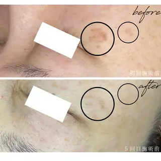 最新シミケアLily de pearlのエステ・リラクイメージ