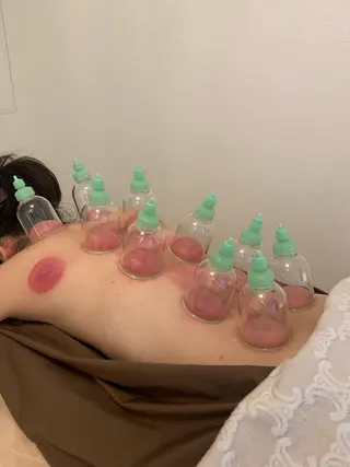 新宿hari-me所属・美容鍼hari-me 新宿のエステ・リラクイメージ