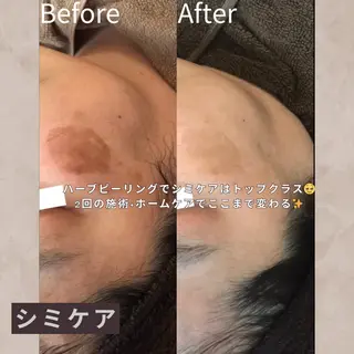 ハーブピーリング専門店YOOTOX所属・大橋 唯のエステ・リラクイメージ