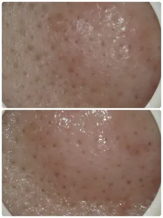 メナード片町 やまもと みくのエステ・リラクイメージ