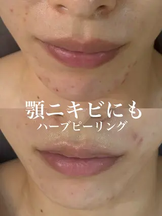 WHITE AQUA 北千住店のエステ・リラクイメージ