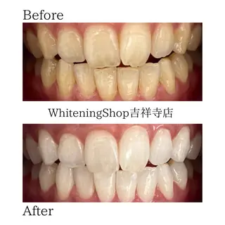 ホワイトニング ショップ吉祥寺店のエステ・リラクイメージ