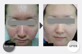 痩身・フェイシャル/if byOrabriller所属・if byOrab riller【イフ】のその他イメージ