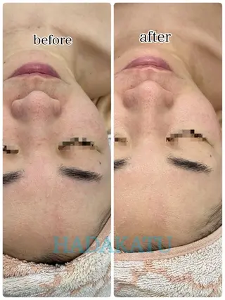 総合エステサロン 肌活のエステ・リラクイメージ