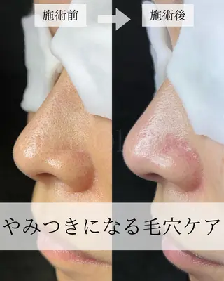 毛穴汚れ改善専門店/ 岸和田/リヒオルオルのエステ・リラクイメージ