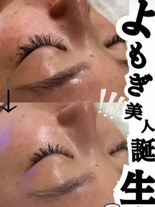 aroma  YURARI所属・韓国艶美人// 毛穴ケア🌹のエステ・リラクイメージ