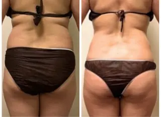 luana-ルアナ-所属・寝ながら痩せる ダイエットluanaのエステ・リラクイメージ