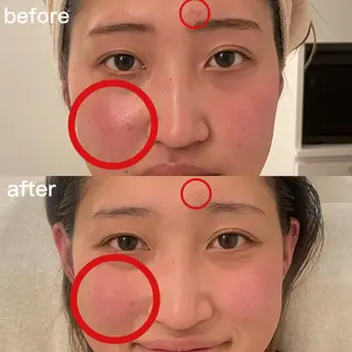 アピタ千代田橋店 POLA THE BEAUTY所属・エステ ツヤ肌 マッサージ POLAのその他イメージ