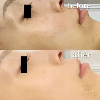 AprilEsthe所属・April EstheSalonのエステ・リラクイメージ