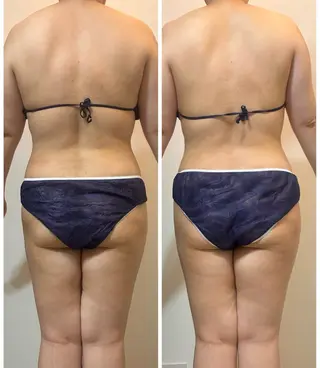 デトックス×ボディメンテナンスサロンShikhara（シカラ）所属・オールハンド筋膜痩身 整体/小顔　中山朝美のエステ・リラクイメージ