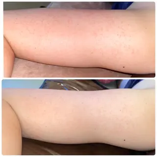 FLEUR大阪・整体 ・ハイフ・痩身・小顔のエステ・リラクイメージ