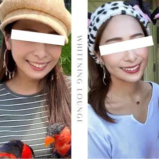 ホワイトニングラウンジ横須賀所属・ホワイトニング Lounge横須賀のその他イメージ