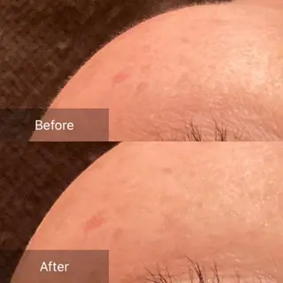 産毛専門店 Bittoのエステ・リラクイメージ