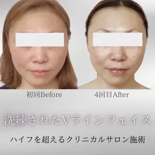 看護師 AYUIのエステ・リラクイメージ