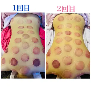 アロマ･美容鍼･カッ ピング「麗」鍼灸院のエステ・リラクイメージ