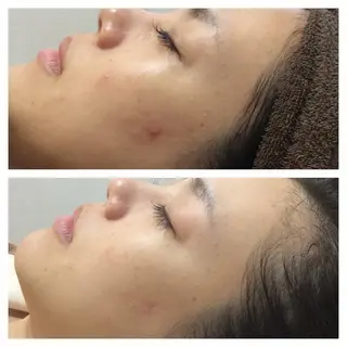 医師推奨サロン ディーキャットリーのエステ・リラクイメージ