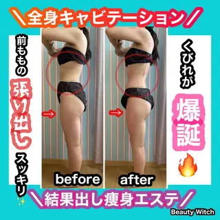 痩身/脱毛/ネイル HARUKAのエステ・リラクイメージ