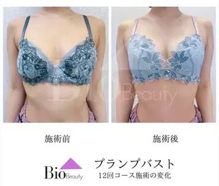 Bio Beauty 神戸本店所属・エステ豊胸マイスター 中前のエステ・リラクイメージ