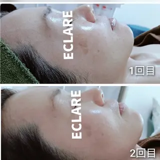 グリーンピール専門店 ECLAREのエステ・リラクイメージ
