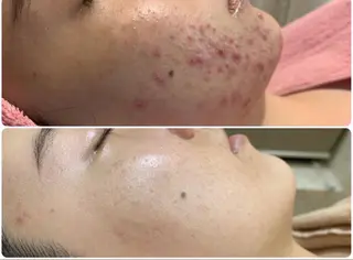 エステ矢野 ジョアアンジェ心斎橋のエステ・リラクイメージ