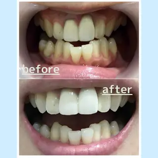 メンズ お手軽ホワイトニングsalon mina所属・武元 奈津美のその他イメージ