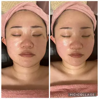 メディカルエステ　痩身·小顔専門サロンBBC 田園調布所属・KEI KOのエステ・リラクイメージ