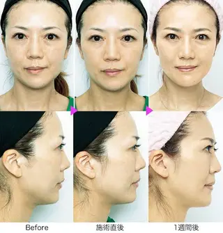 ■超絶小顔&肌管理室■所属・🦋整形級の究極美顔 本格韓国式小顔🦋のエステ・リラクイメージ