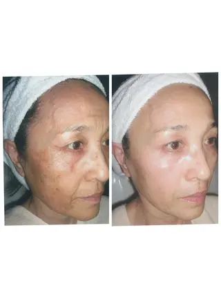 マドンナ 富士店のエステ・リラクイメージ