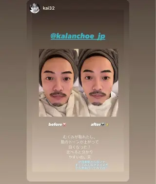 肌質改善 KALANCHOEのエステ・リラクイメージ