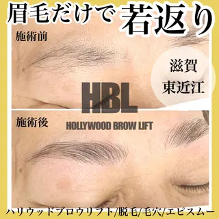 アイブロウ epismoo 脱毛/HBL/毛穴の眉毛・アイブロウイメージ