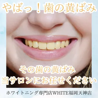 ホワイトニング専門店 WHITE天神店のエステ・リラクイメージ