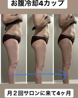 エステ／ネイル/脱毛 R.Msalonのネイルデザイン