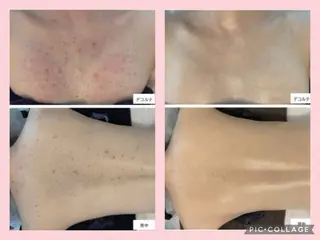 ﾄｰﾀﾙｽｷﾝｹｱ美容Room所属・トータルスキンケア 美容Roomのエステ・リラクイメージ