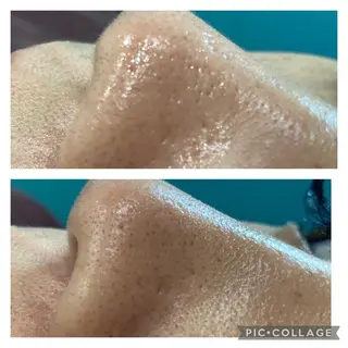 ﾄｰﾀﾙｽｷﾝｹｱ美容Room所属・トータルスキンケア 美容Roomのエステ・リラクイメージ