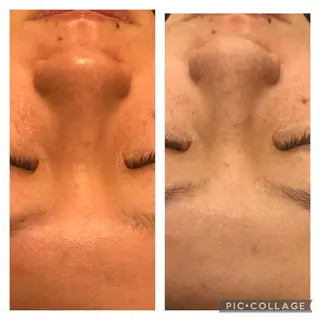 ミディアム カラー パーマ ヘアアレンジ メンズ キッズ ネイル マツエク・マツパ アニメ,Vオタク× 即効痩せエステサロンのエステ・リラクイメージ