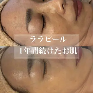 WHITE AQUA 北千住店のエステ・リラクイメージ