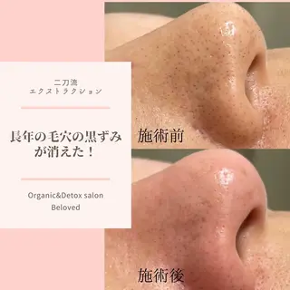 Organic&Detox salon Beloved所属・Beloved えなかのエステ・リラクイメージ